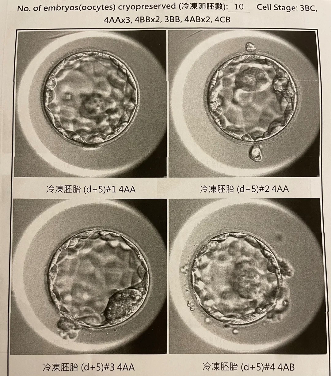Day5 囊胚結果出爐啦🎉,45岁试管代孕成功经验,国内有偿供卵医院